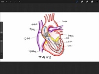 https://tcs.teambition.net/thumbnail/312dadf050ac5eb7898468618d9c3ea550a3/w/200/h/200纸杯定做 设计图附件